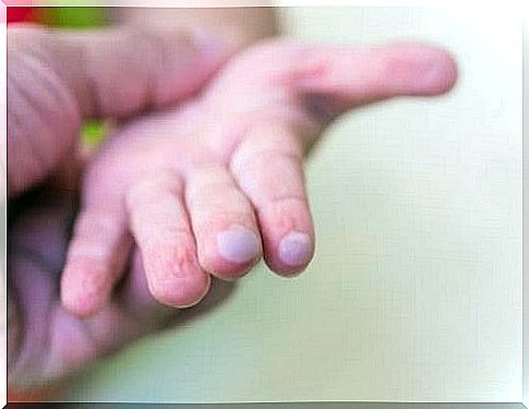 Blisters in children: How to treat them