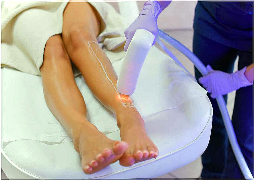 A woman undergoing laser hair removal on her legs