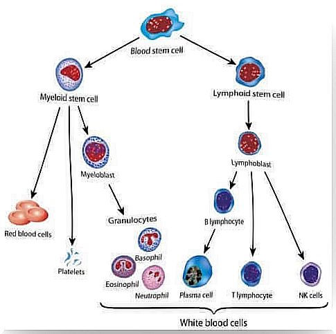 Pediatric leukemia most often occurs in children under 5 years of age