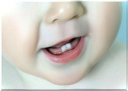 The baby's first teeth: Everything you need to know